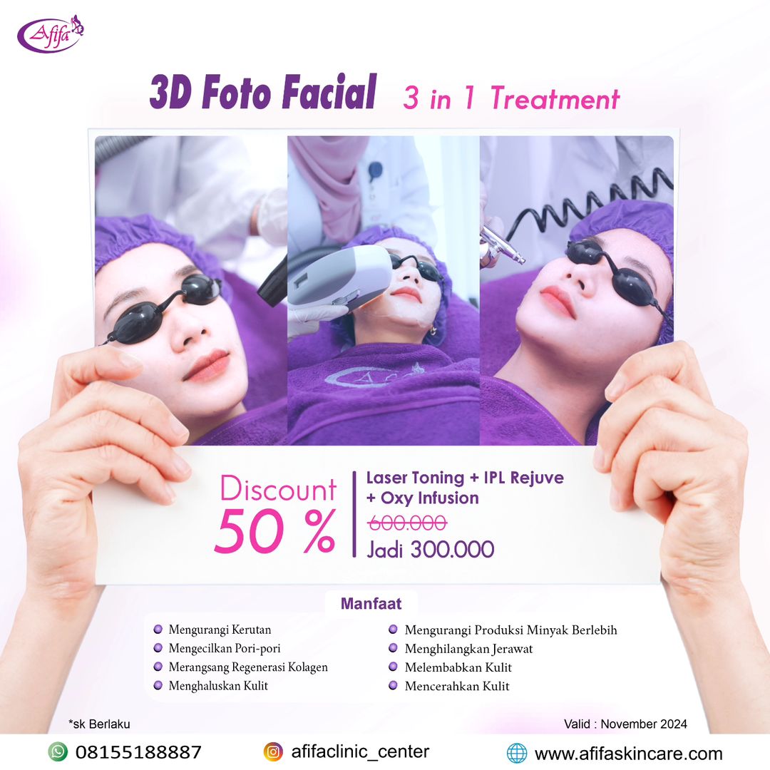 November 3D Foto Facial